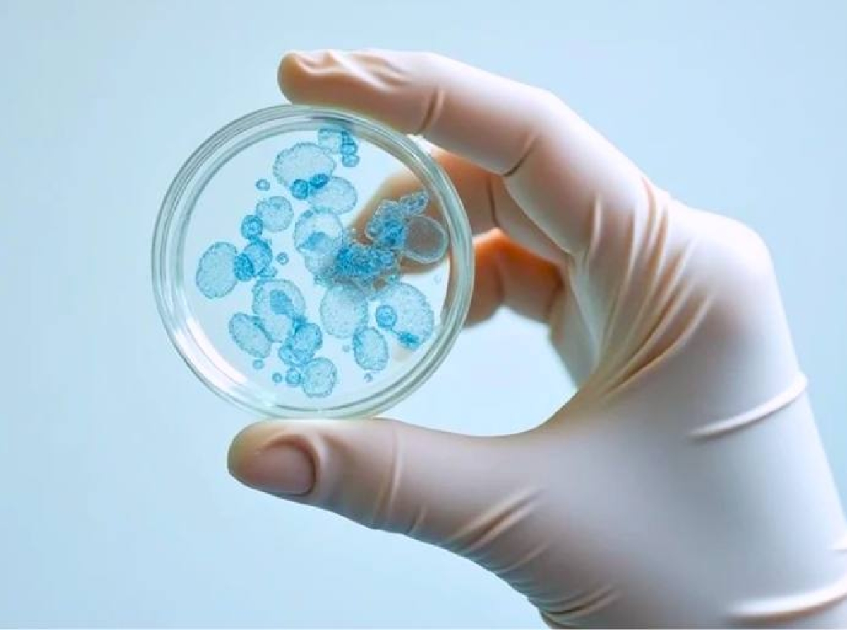 Tasas récord de infecciones por E.coli y Listeria en la UE/EEE en 2023